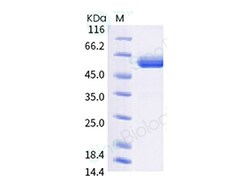 Sino Biological SARS-CoV-2 Spike RBD (R346K, E484K, N501Y) Protein (Fc