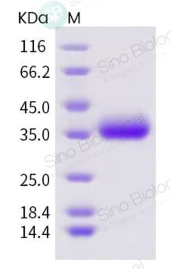 Sino Biological SARS-CoV-2 (2019-nCoV) Spike RBD-His Recombinant Protein