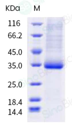 Sino Biological SARS-CoV-2 Spike RBD (P479L) Protein (His Tag) 100ug, Quantity: