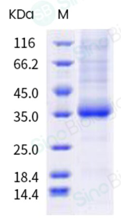 Sino Biological Protein SARS-CoV-2 Spike 100ug, Quantity: Each of 1