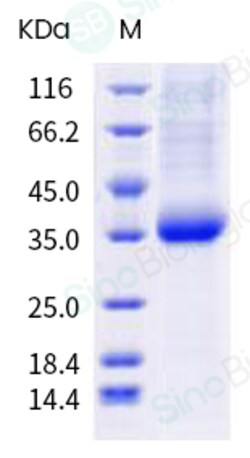 Sino Biological SARS-CoV-2 Spike RBD (E484D) Protein (His Tag), Quantity: