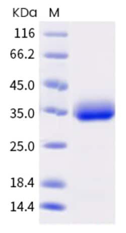 Sino Biological SARS-CoV-2 Spike Protein 100ug (Sino Biological), Quantity: