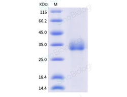 Sino Biological SARS-CoV-2 B.1.1.529 (Omicron) Spike RBD Protein (His Tag)