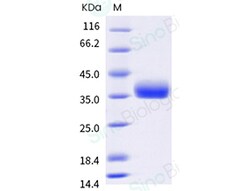 Sino Biological SARS-CoV-2 B.1.1.529 sublineage BA.2 (Omicron) Spike RBD
