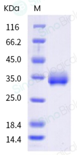 Sino Biological SARS-CoV-2 (C.36.3) Spike RBD Protein (His Tag) (HPLC-verified),