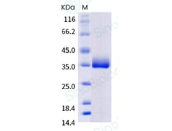 Sino Biological SARS-CoV-2 (B.1.214.2) Spike RBD Protein (His Tag) (HPLC-verified),