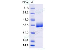 Sino Biological SARS-CoV-2 (B.1.640.2) Spike RBD Protein (His Tag) (HPLC-verified),