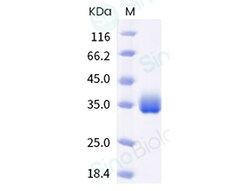 Sino Biological SARS-CoV-2 (BA.1.1) Spike RBD Protein (His Tag) 100ug,