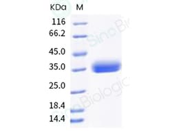 Sino Biological SARS-CoV-2 (BA.2.12.1) Spike RBD Protein (His Tag) 100ug,