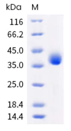 Sino Biological SARS-CoV-2 (BA.2.75) Spike RBD Protein (His Tag) (HPLC-verified)