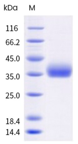 Sino Biological SARS-CoV-2 Spike Protein 100ug (Sino Biological), Quantity: