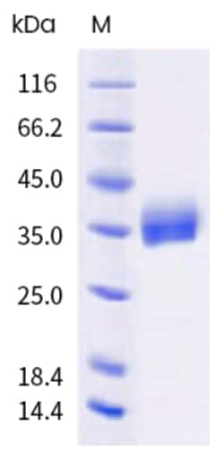 Sino Biological SARS-CoV-2 Spike Protein 100ug (Sino Biological), Quantity: