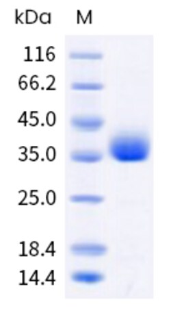 Sino Biological SARS-CoV-2 XBB (Omicron) Spike RBD Protein (His Tag) (HPLC-verified)