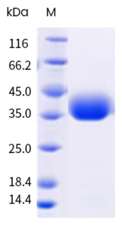 Sino Biological&nbsp;SARS-CoV-2 NB.1.8.1 (Omicron) Spike RBD Protein (His Tag) 100