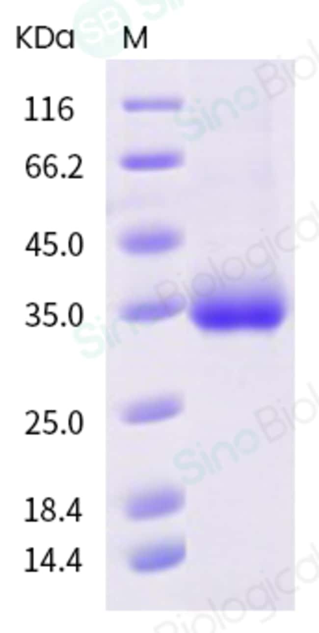 Sino Biological SARS-CoV-2 (2019-nCoV) Spike RBD(S494P)-His Recombinant ...