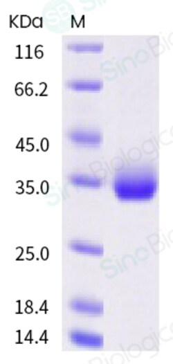Sino Biological SARS-CoV-2 (2019-nCoV) Spike RBD(S477N)-His Recombinant