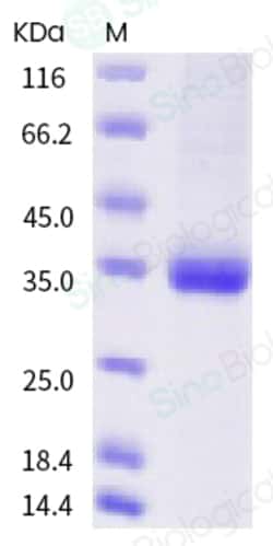 Sino Biological SARS-CoV-2 (2019-nCoV) Spike RBD(K417N)-His Recombinant