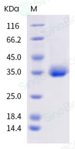 Sino Biological SARS-CoV-2 (2019-nCoV) Spike RBD(K417N, E484K, N501Y)-His