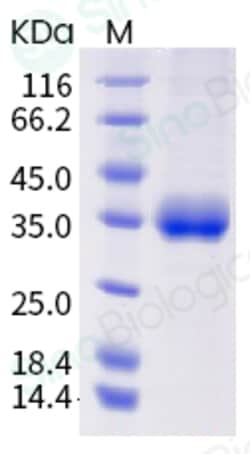 Sino Biological SARS-CoV-2 (2019-nCoV) Spike RBD (K417T, E484K, N501Y)