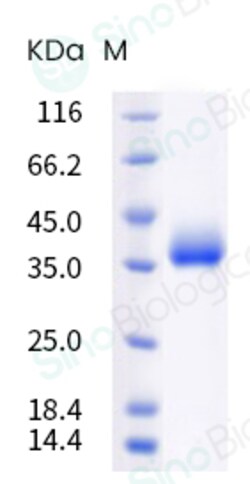 Sino Biological SARS-CoV-2 Spike RBD (L452R,T478K) Protein (His Tag), Quantity: