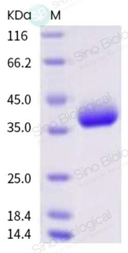 Sino Biological SARS-CoV-2 (2019-nCoV) Spike RBD-AVI & His Recombinant