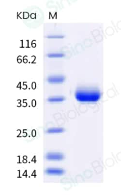 Sino Biological SARS-CoV-2 Spike RBD (L452R, T478K) Protein (His & AVI