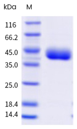 Sino Biological&nbsp;SARS-CoV-2 XEC (Omicron) Spike RBD Protein (His & AVI Tag), Biotinylated (HPLC-verified) 20