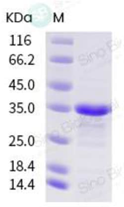 Sino Biological SARS-CoV-2 (2019-nCoV) Plpro/papain-like protease-His recombinant