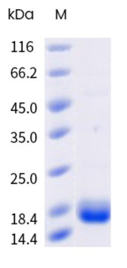 Sino Biological&nbsp;SARS-CoV-2 (2019-nCoV) NSP10-His Recombinant Protein, Biotinylated 20 µg