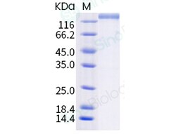 Sino Biological Human coronavirus (HCoV-NL63) Spike S1+S2 Protein (ECD,