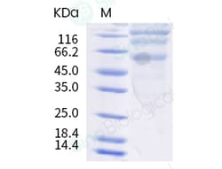 Sino Biological Human coronavirus HKU1 (isolate N5) (HCoV-HKU1) Spike S1+S2