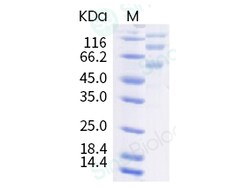 Sino Biological Human coronavirus (HCoV-OC43) Spike S1+S2 Protein (ECD,