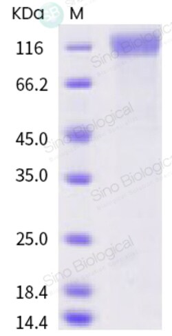 Sino Biological Human coronavirus (HCoV-OC43) Spike S1 Protein (His Tag)