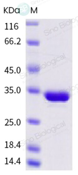 Sino Biological Recombinant Streptococcus pyogenes IdeS Protein (His Tag),
