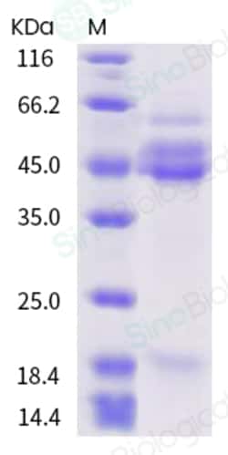 Sino Biological Human respiratory syncytial virus (RSV) Fusion Protein