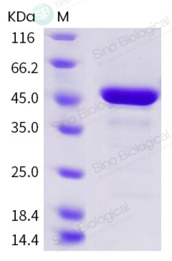 Sino Biological Human coronavirus (HCoV-229E) Nucleocapsid Protein (His