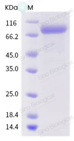 Sino Biological Influenza A H1N1 (A/Wisconsin/28/2011) Hemagglutinin /