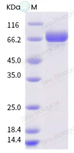 Sino Biological Influenza A H3N2 (A/swine/England/90591/1997) Hemagglutinin