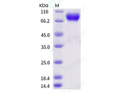 Sino Biological Influenza A H1N1 (A/Guangdong-Maonan/SWL1536/2019) / (A/Hawaii/70/2019)