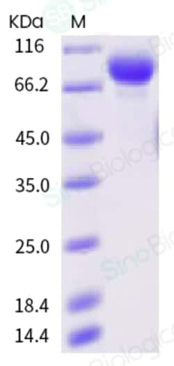 Sino Biological Influenza A H3N2 (A/Hong Kong/2671/2019) Hemagglutinin