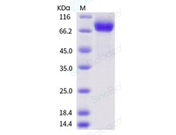 Sino Biological Influenza B (B/Washington/02/2019) Hemagglutinin / HA Protein