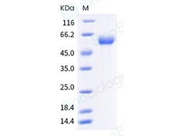 Sino Biological Influenza A H1N1 (A/swine/Canada/01093/2006) Neuraminidase