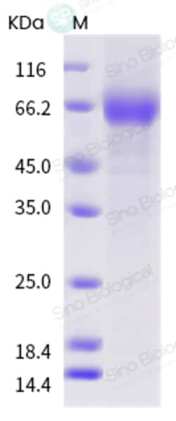 Sino Biological Influenza A H1N1 (A/Arizona/13/2008) Neuraminidase / NA