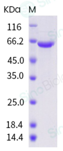 Sino Biological Influenza B (B/Washington/02/2019) Nucleoprotein / NP Protein