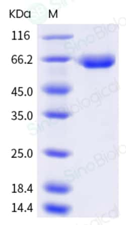 Sino Biological Influenza A H1N1 (A/Brisbane/02/2018) Neuraminidase / NA