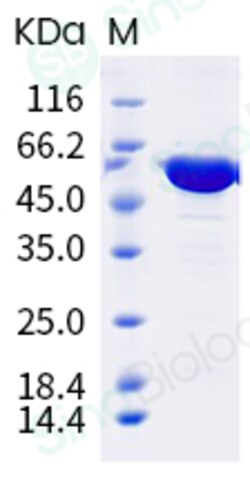 Sino Biological Influenza A H1N1 (A/Michigan/45/2015) Nucleoprotein / NP