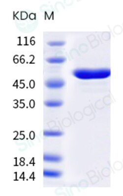 Sino Biological Influenza A H3N2 (A/Cambodia/e0826360/2020) Nucleoprotein