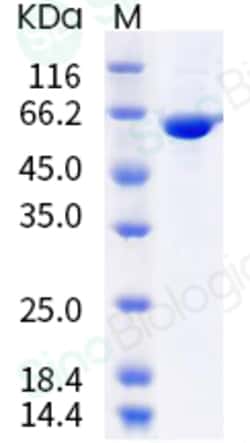 Sino Biological Influenza A H3N2 (A/Hong Kong/4801/2014) Nucleoprotein