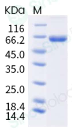 Sino Biological Influenza A H1N1 (A/Wisconsin/588/2019) / (A/Victoria/2570/2019)