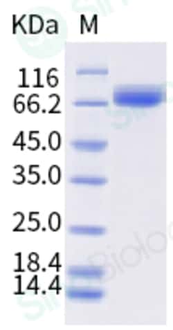 Sino Biological Influenza A H1N1 (A/Wisconsin/588/2019) / (A/Victoria/2570/2019)